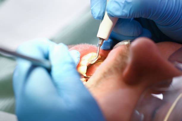 Best Weekend Emergency Dentist in Tower Lakes, IL