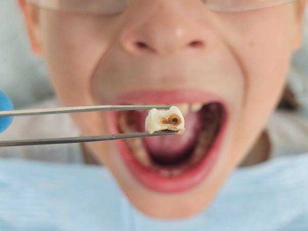 Best Emergency Cosmetic Dentistry in Tower Lakes, IL